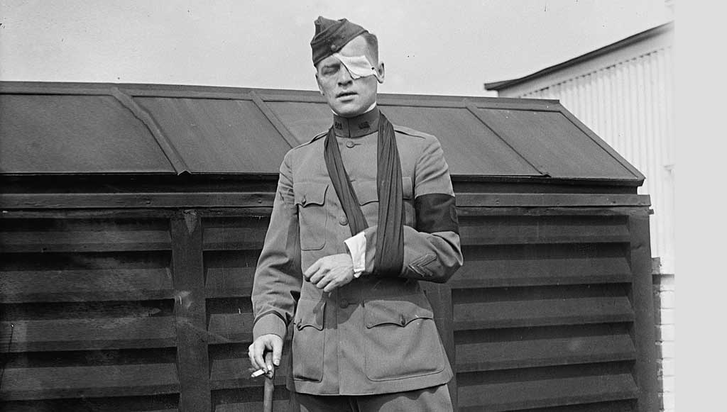 Floyd-Gibbons-after-being-wounded